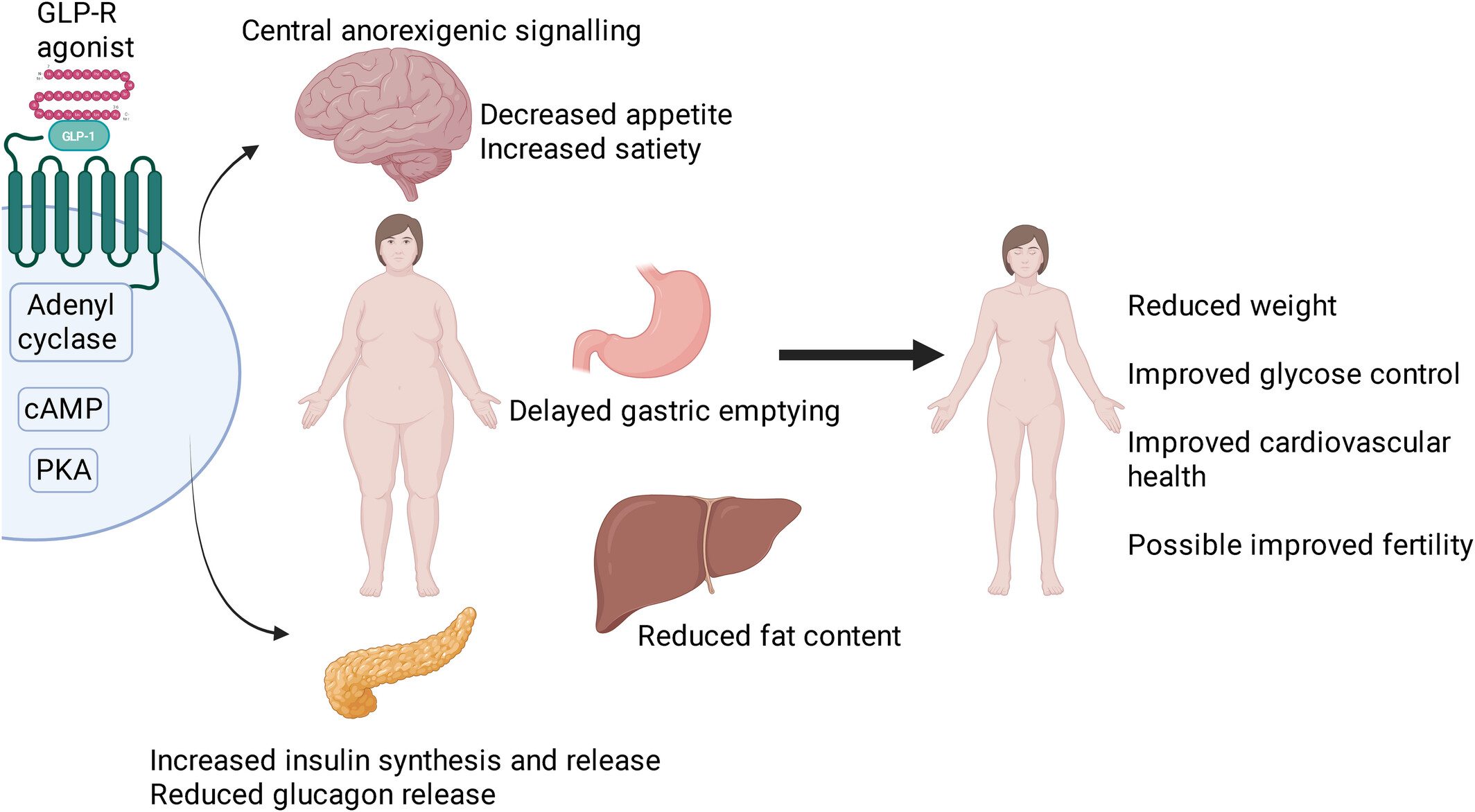 Glucagon-Like Peptide-1 Receptor Agonists in Pregnancy: Evaluating Periconception Exposure and Perinatal Outcomes