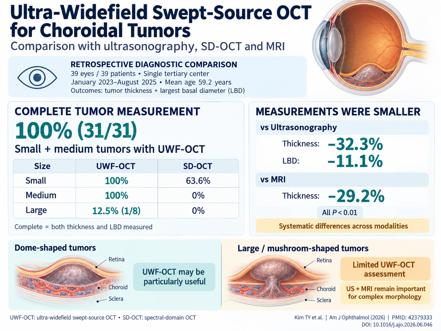 超广角扫频源OCT在脉络膜肿瘤评估中的应用:与超声、SD-OCT及MRI的比较分析