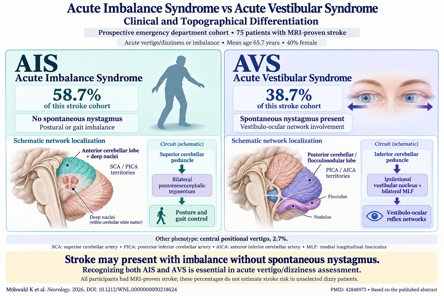 Differentiating Acute Imbalance Syndrome from Acute Vestibular Syndrome in Stroke-Related Vertigo: Clinical and Neuroanatomical Insights